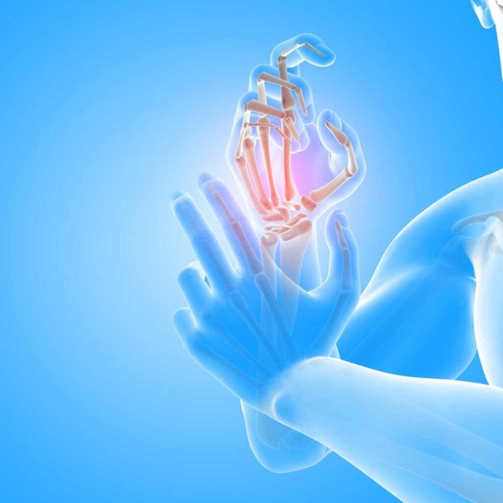 Small Fiber Neuropathy