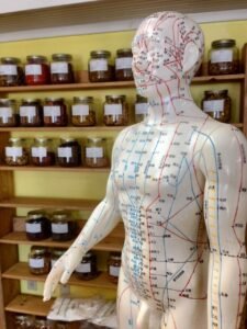 Can Acupuncture Help with POTS? | Exploring Holistic Treatment Options