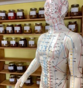 Acupuncture for POTS | How Holistic Treatments Can Support Dysautonomia Relief